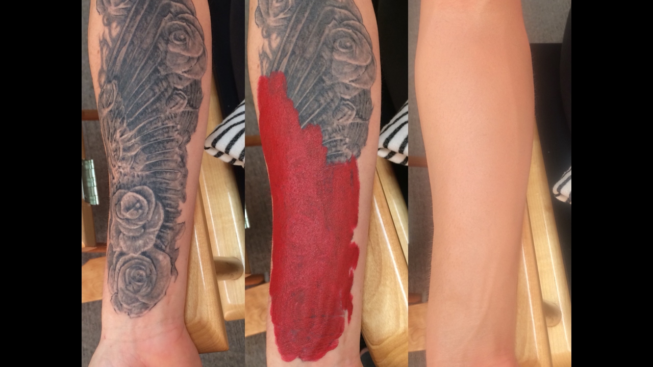hannover Cover up tattoo