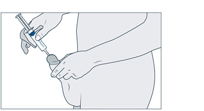 Prostata massage anleitung